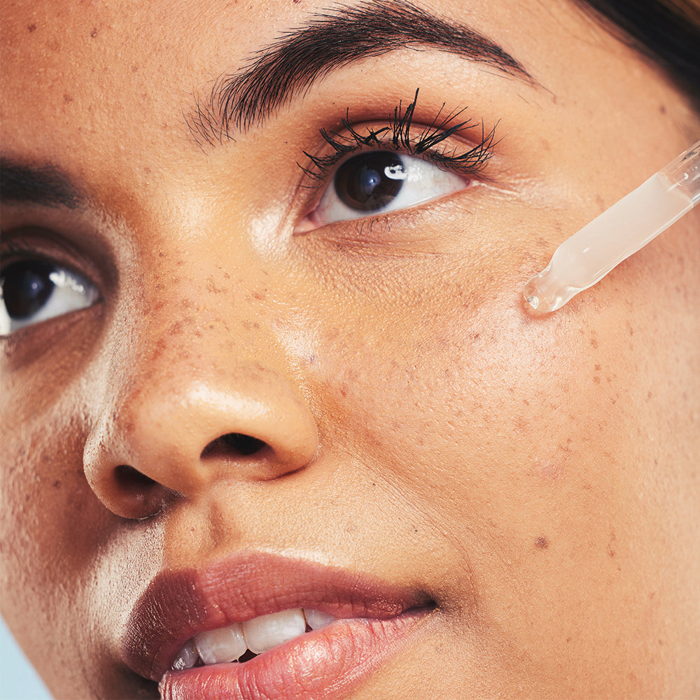 Comment réduire les cicatrices d’acné efficacement ?