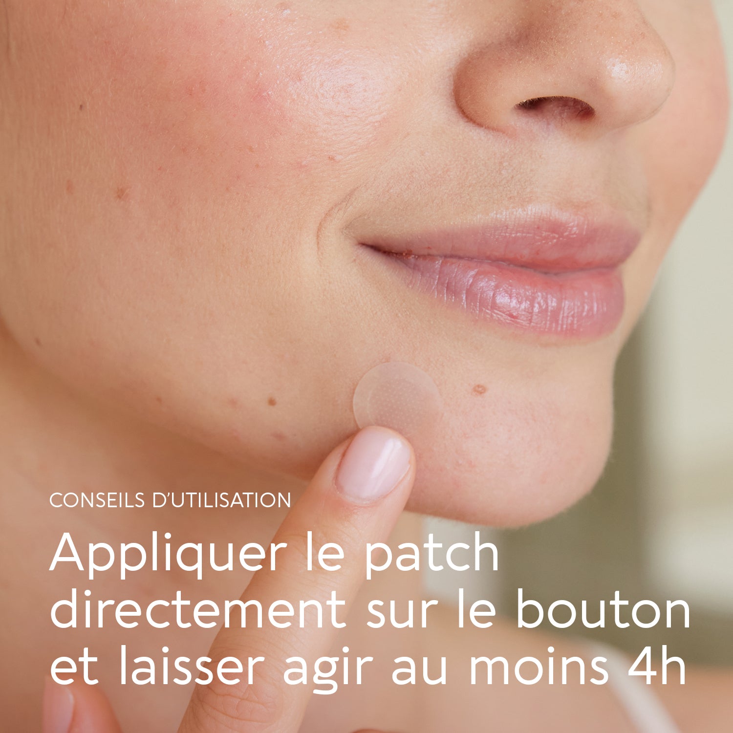 Active pimple patch