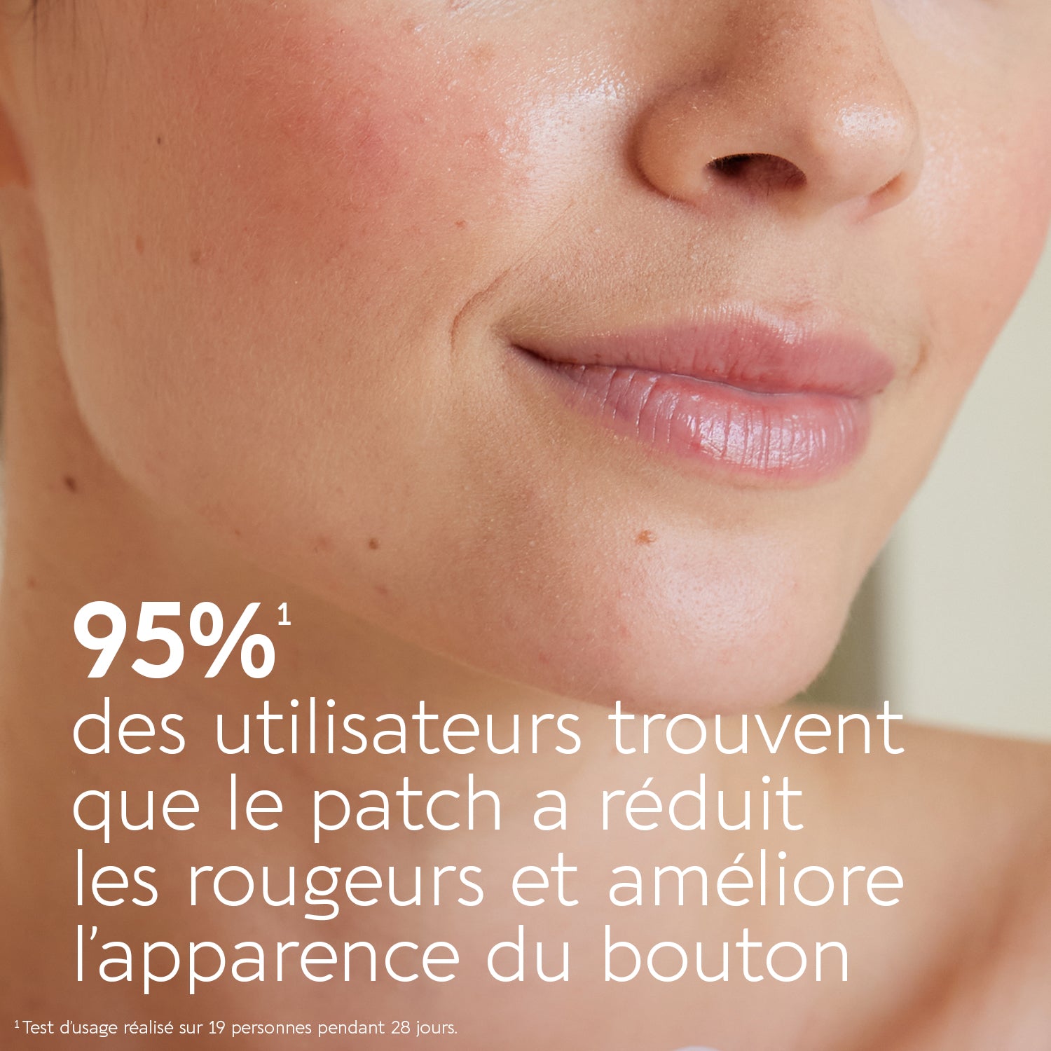 Active pimple patch