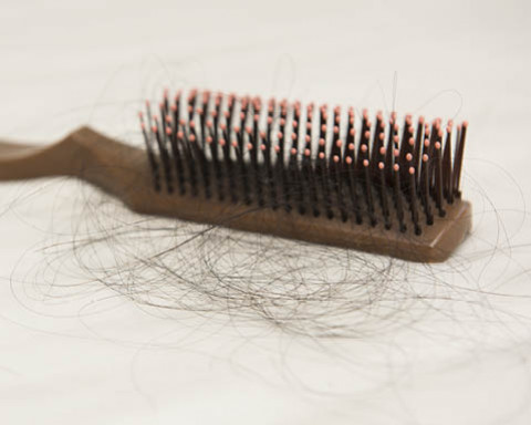 Comment lutter contre la perte de cheveux ? | Biocyte
