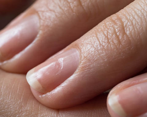 Comment soigner les ongles abîmés ?