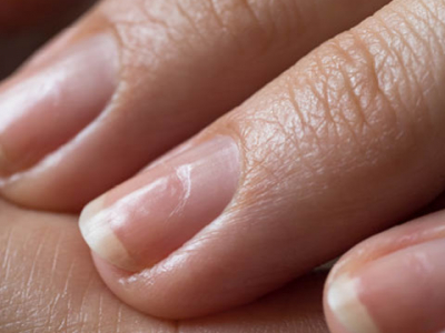 Comment soigner les ongles abîmés ?